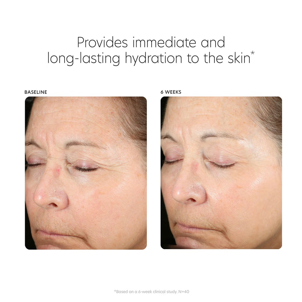 Before and after photos showing improved skin hydration and smoothness after 6 weeks of PCA SKIN Hyaluronic Acid Boosting Serum